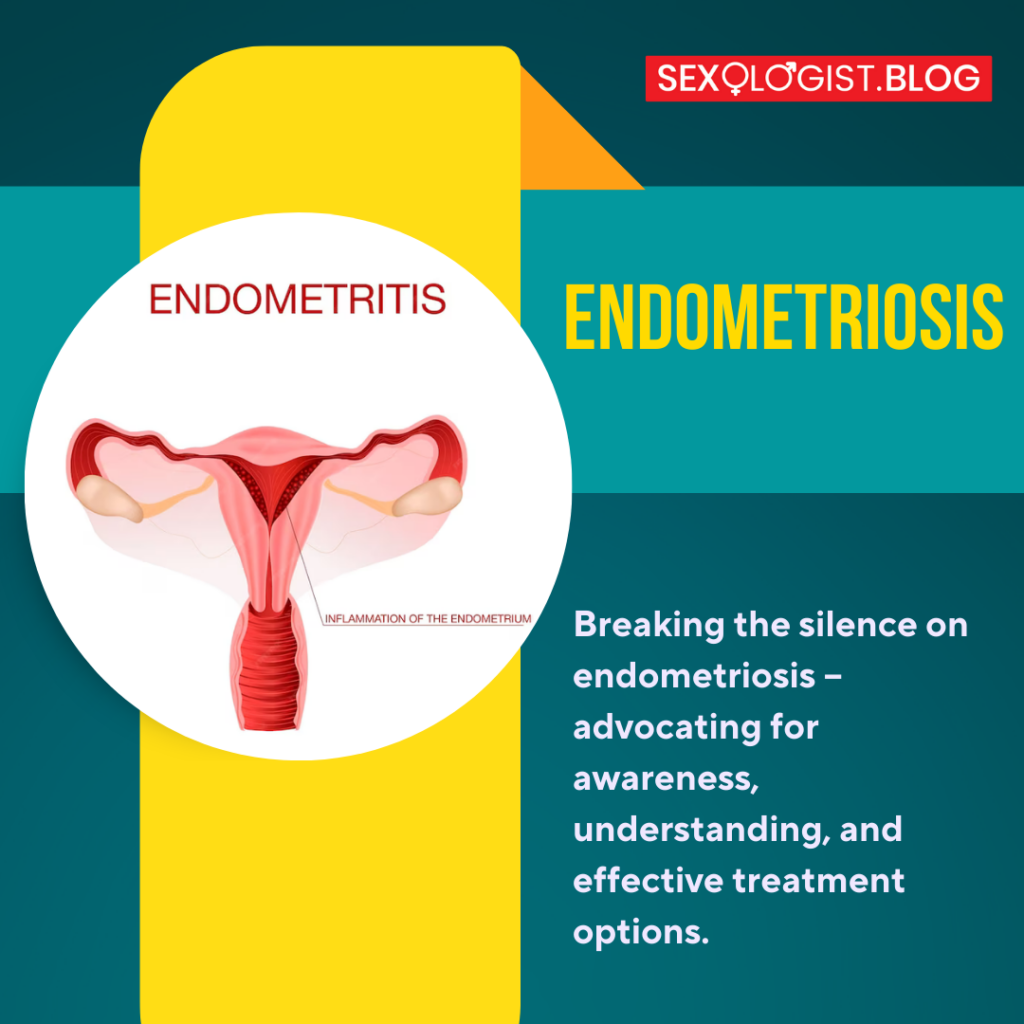 Endometriosis 